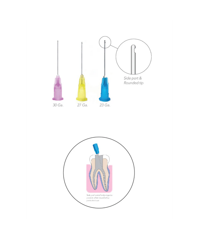 Pac-Dent - OptiProbe, Endo Irrigation Needles, Side-Vent, 30 Ga, Purple, 100/Pk