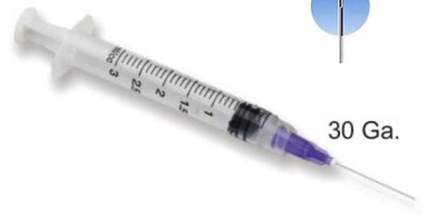 Mark3 - Endo Irrigation Kit 30Ga. 3Cc Purple. Contains 100 X 3 Cc Luer-Lock Endo Irrigation
