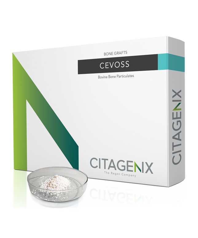 Citagenix - CevOss 1cc Bovine Bone Graft .25-1mm, 1 Vial/Box