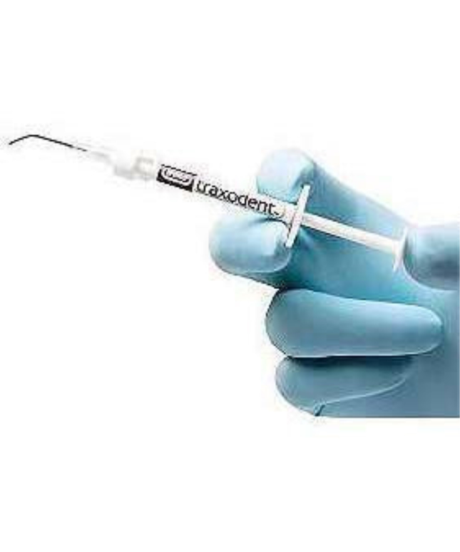 Premier - Traxodent Dispensing Tips - 50/Pk