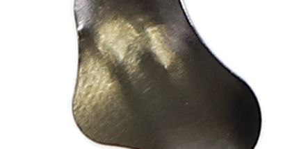 Contact Matrix Subgingival 1 x 5 stuk