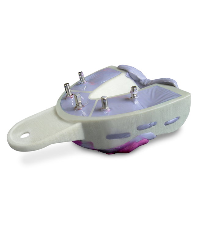 Miratray Implant Advanced Intro Kit 6/Bx